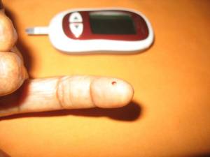 Diabetes-fingerprick testing for blood glucose